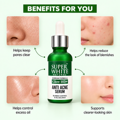Super White Natural Anti Acne Serum – Blemish Care