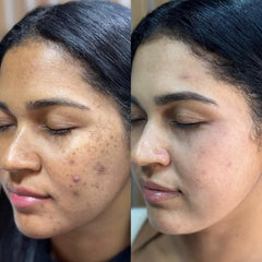 Vitamin C Serum for Glowing Skin | Brightening, Dark Spot