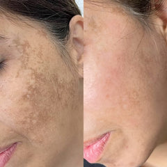 Vitamin C Serum for Glowing Skin | Brightening, Dark Spot