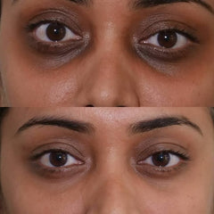 Vitamin C Serum for Glowing Skin | Brightening, Dark Spot
