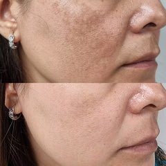Vitamin C Serum for Glowing Skin | Brightening, Dark Spot