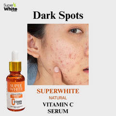 Super White Natural Vitamin C serum bottle next to a close-up of skin with dark spots and acne marks for treatment.